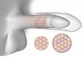 Increased penis volume